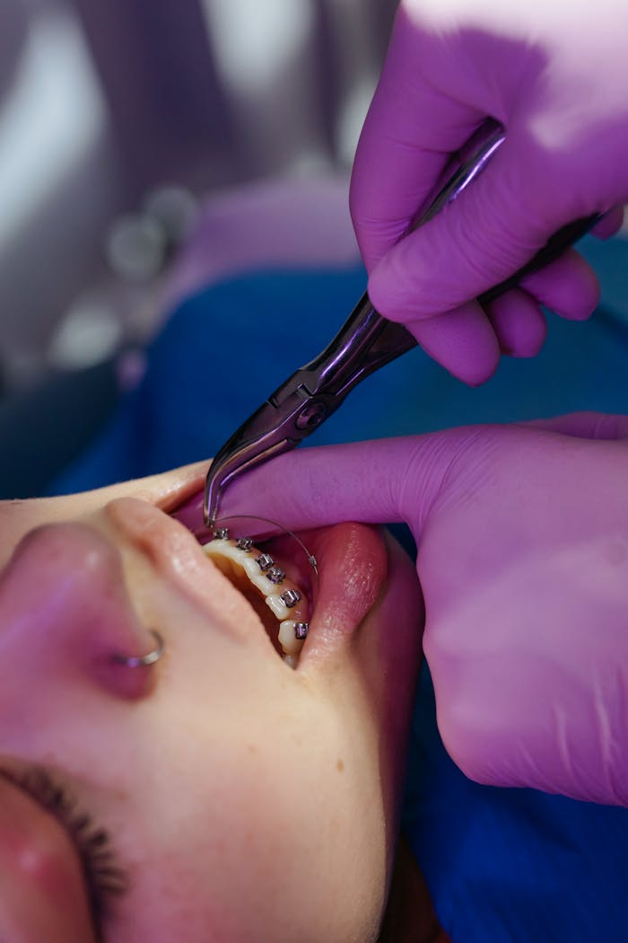 Detailed view of a dental procedure involving braces with medical gloves and tools.