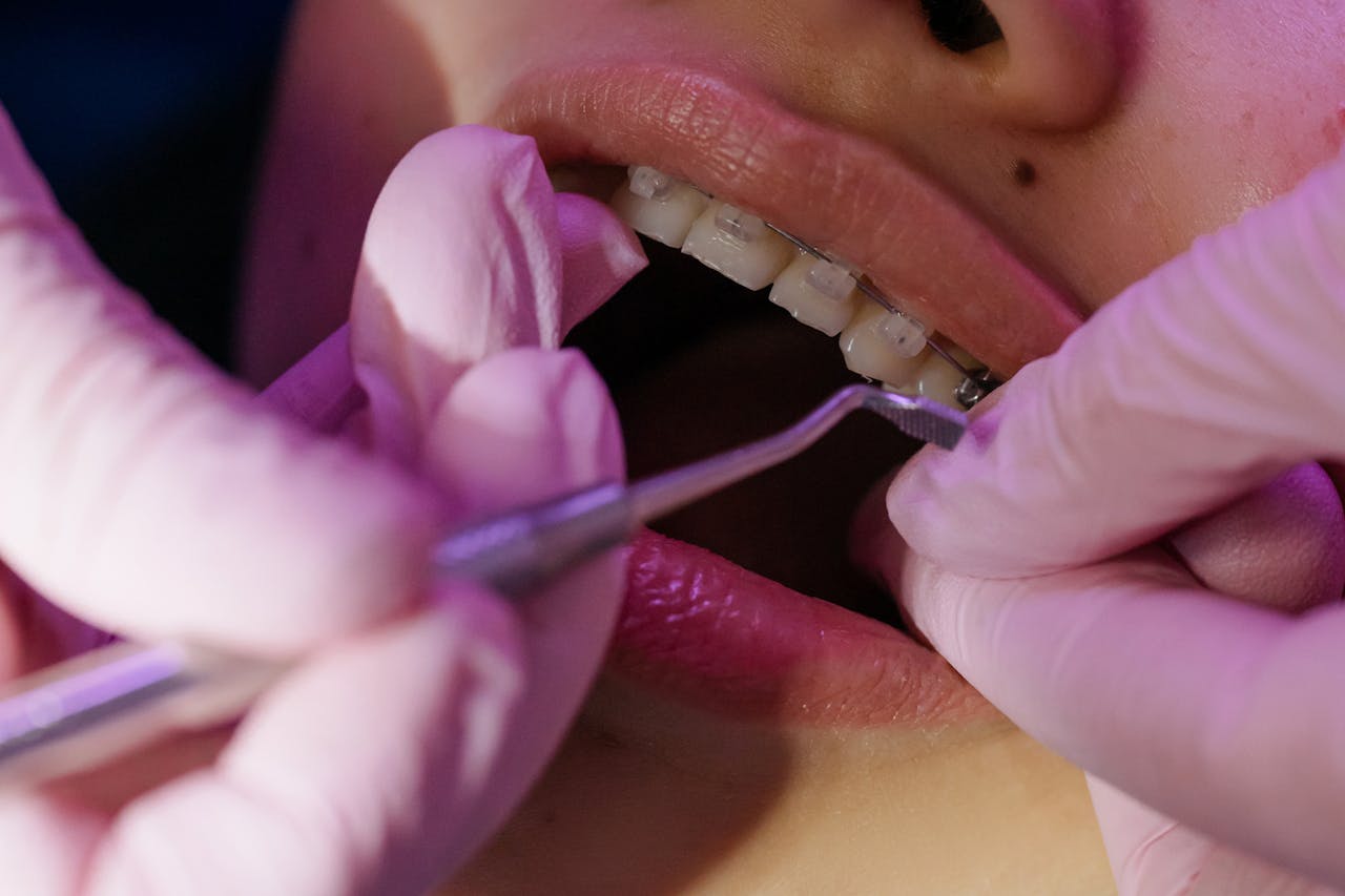 A dentist carefully examines orthodontic braces during a dental procedure.